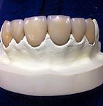 Oral Rehabilitation at Bioral Dental Group