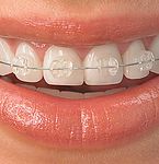Orthodontics & Dentofacial Orthopedics at Bioral Dental Group