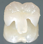 Restorative Dentistry at Bioral Dental Group